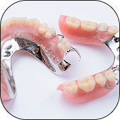 Dentures & Partial Dentures
