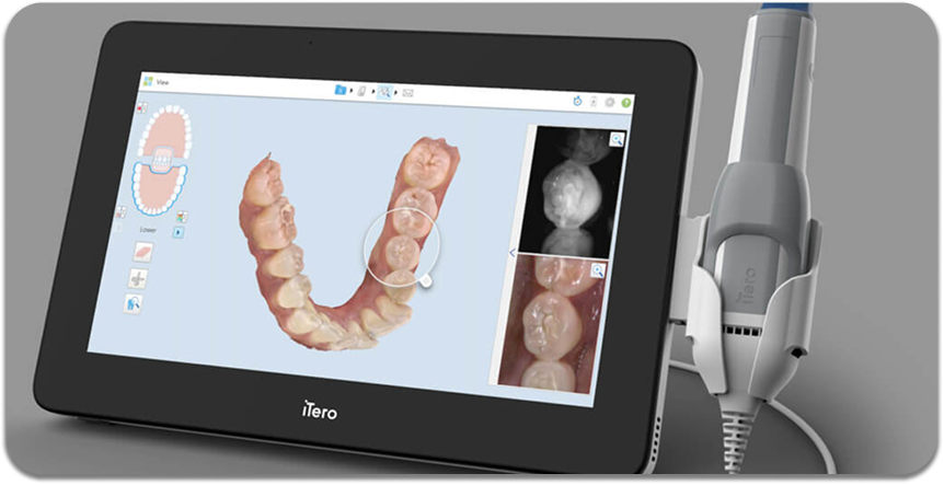 itro-digital-scanner