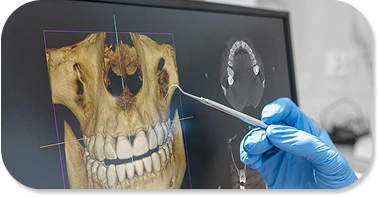 CT 3D cone beam scanner